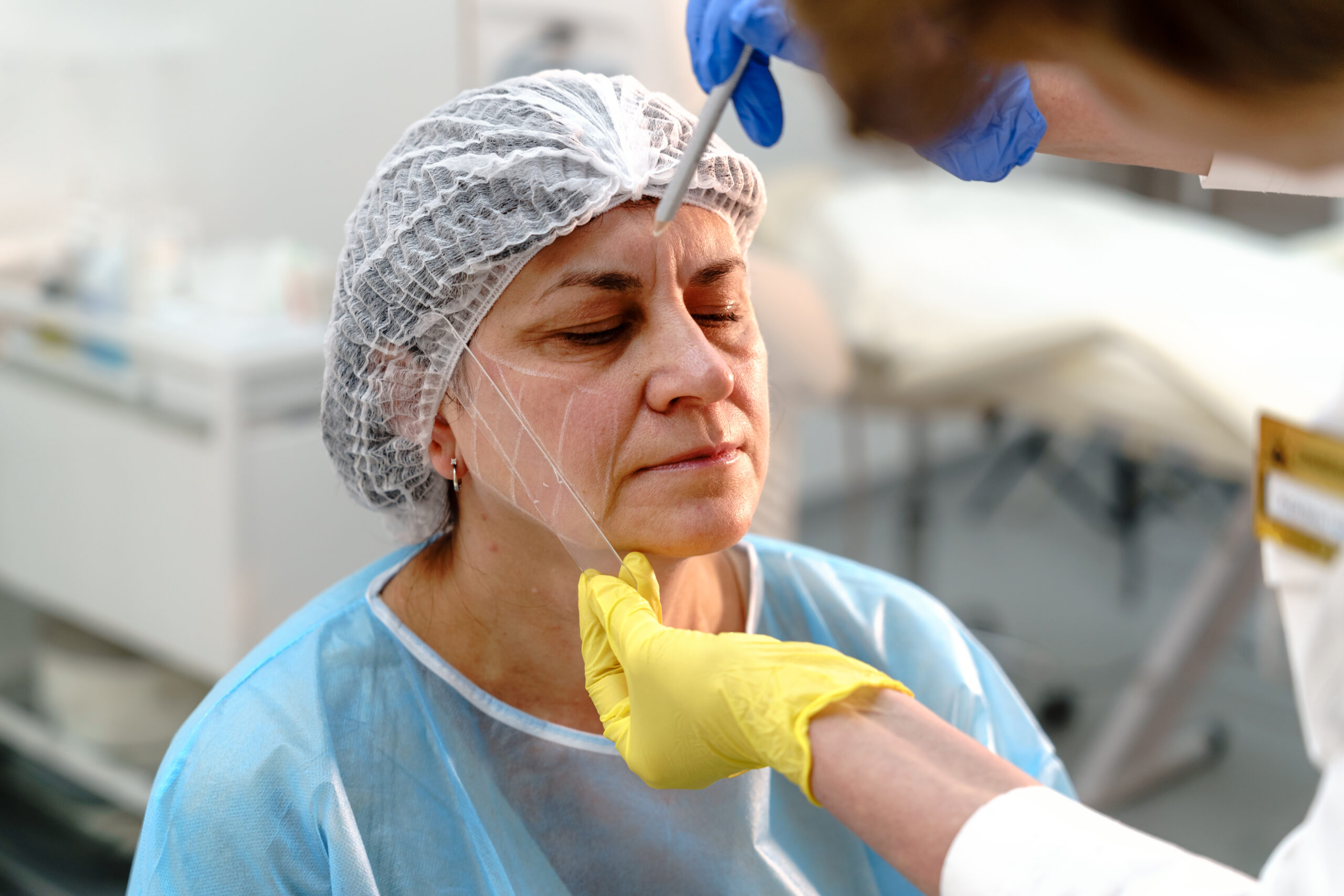 Aesthetic professional performing facial mapping on a mature woman client in a clinical setting, preparing for precise skin treatment application