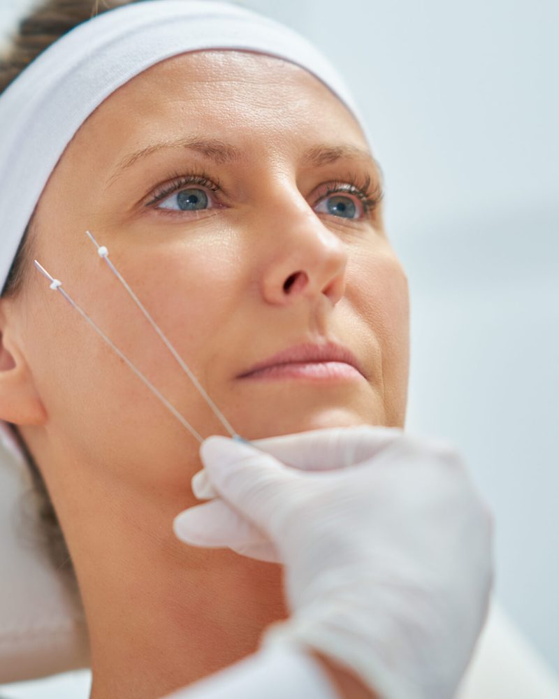 A scene of medical cosmetology treatments botulinum injection. High quality photo